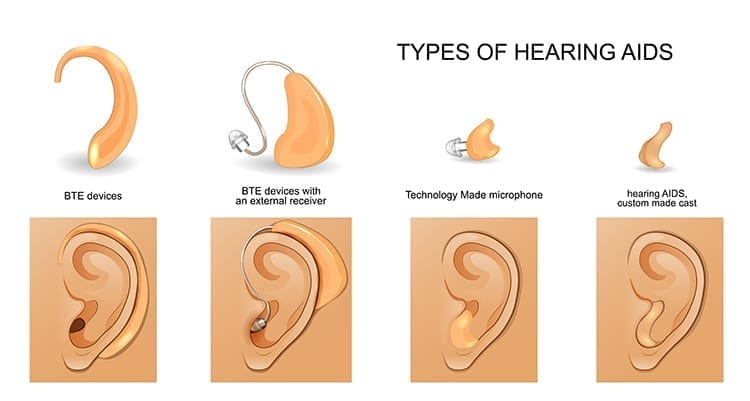 Graphic showing types of hearing aids