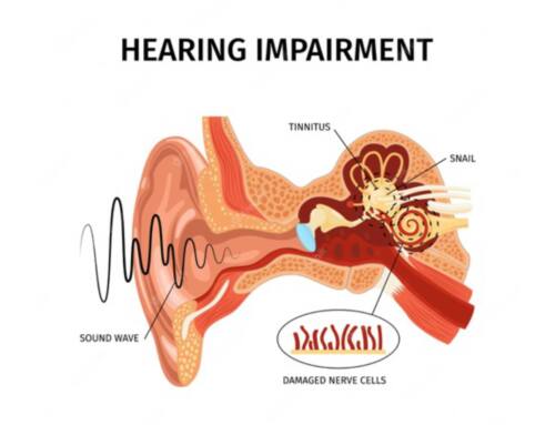 Tinnitus Treatment: Exploring Various Approaches for Effective Relief